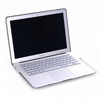 Supremery Apple Macbook Pro Retina 15 (15.4) Case Laptop Bag Hard - Shell - Case Bag Sleeve Case (Macbook Pro 15 Retina, hardcase givré noir)